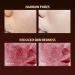 Silicone LED Photon Facial Mask