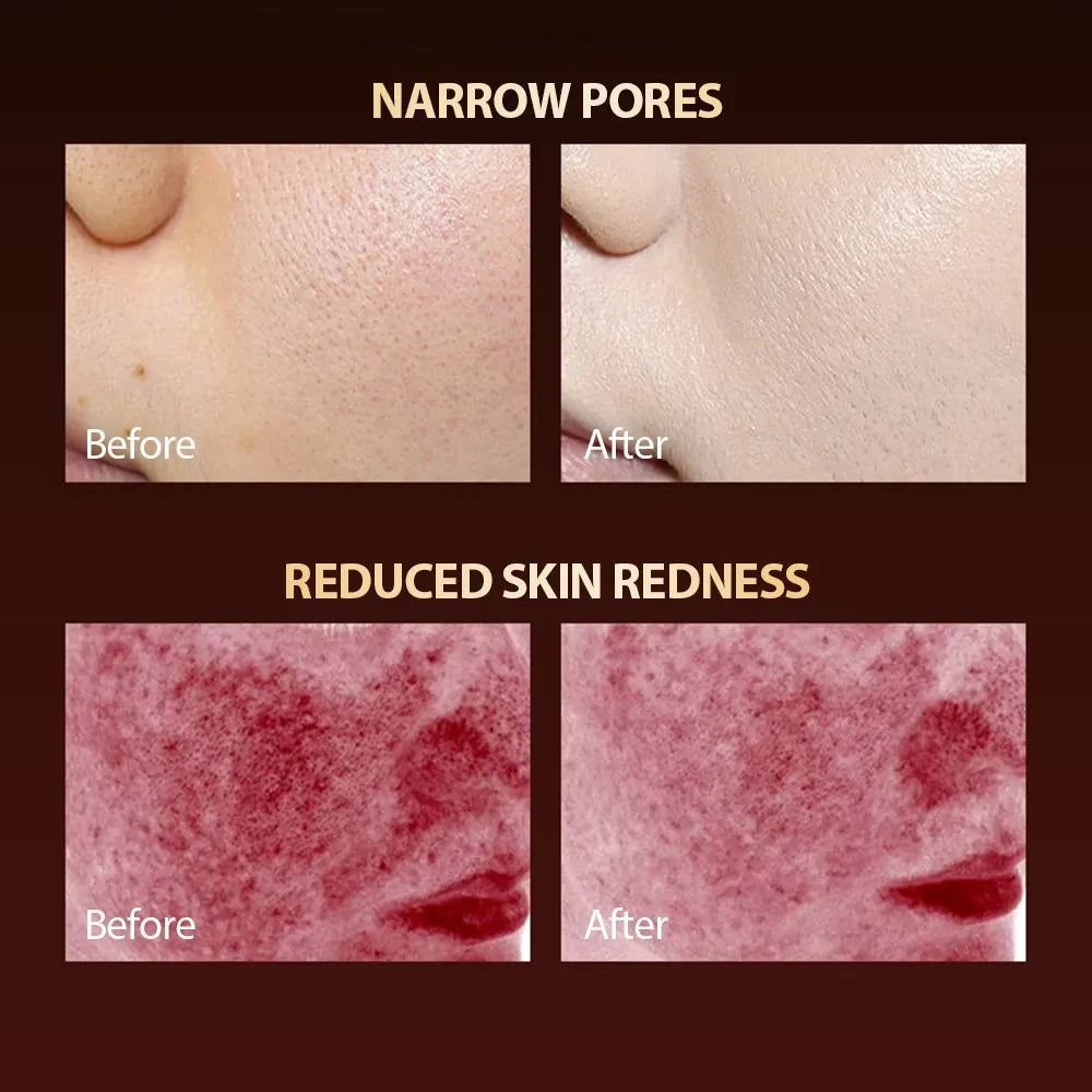 Silicone LED Photon Facial Mask